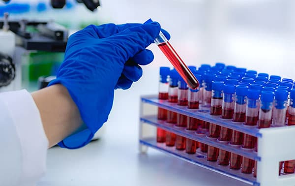 Researcher pulling a vial with a sample out of a rack.