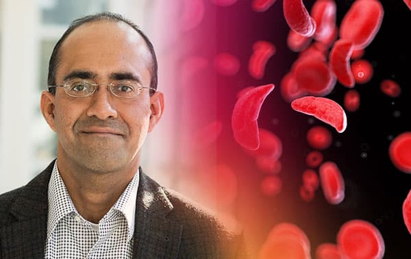 Researcher loading a sample on a microscope slide.