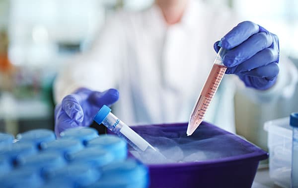 Researcher working with samples in dry ice.