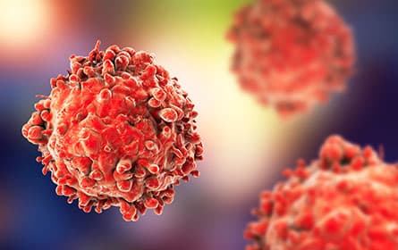 Leukemia white blood cells, 3d illustration. cancer cells