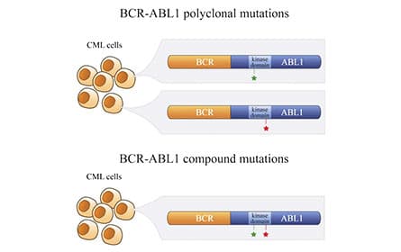 Illustration of Polyclonal versus compound mutations in a subset of patients who develop clinical resistance to ABL1 TKIs.