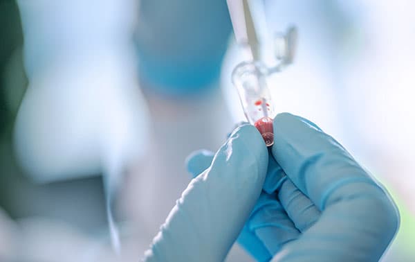 Researcher filling small sample tube.