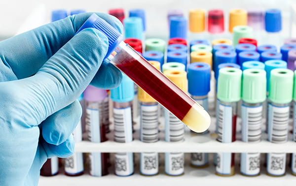 Researcher holding tube with blood sample.