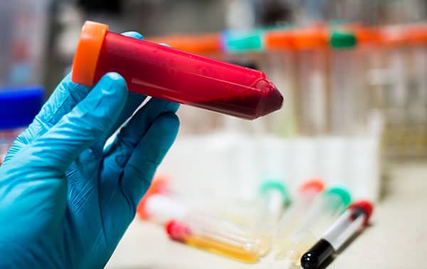 Scientist with blood sample in larger tube.