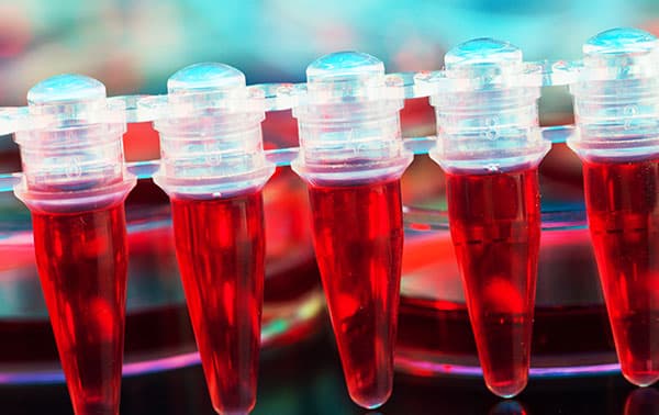 Stem cells in a microtube