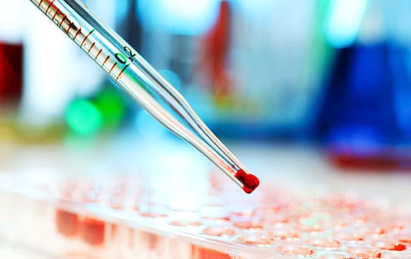 Researcher holding a dropper with a sample loading into a tray.