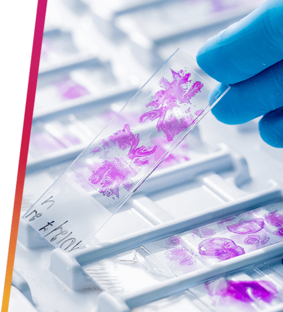 Researcher holding glass histology slides.