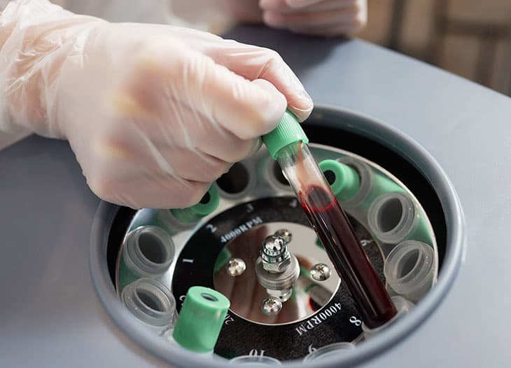 Technician loading a vial into a centrifuge.